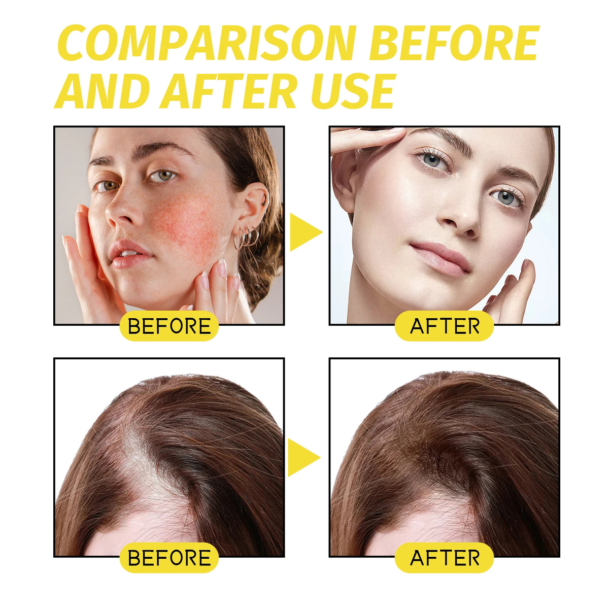 Eelhoe Hair Growth Essential Oil – Fuller, Thicker Hair Hair Growth Oil Qst