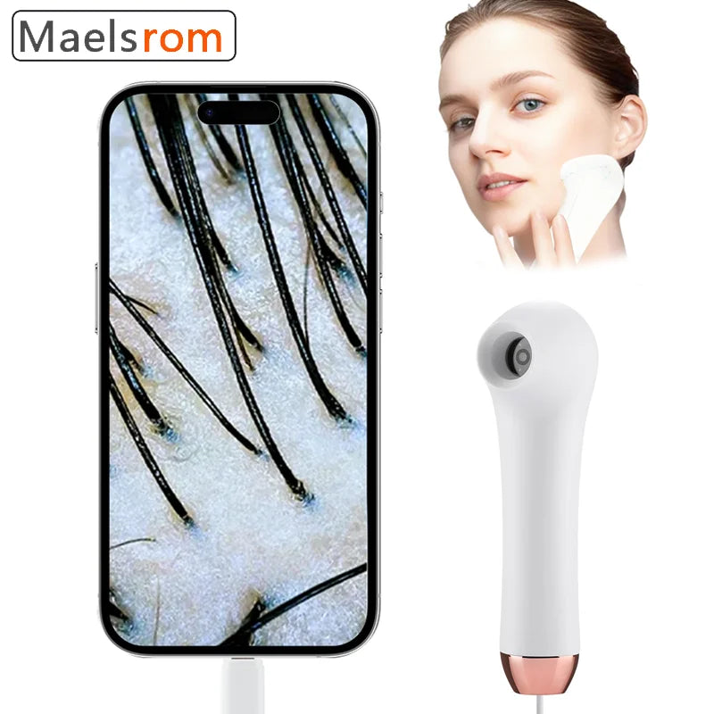Maelsrom Wireless Scalp & Skin Analyzer – 4x HD Camera Skin Scalp Analyzer Qst