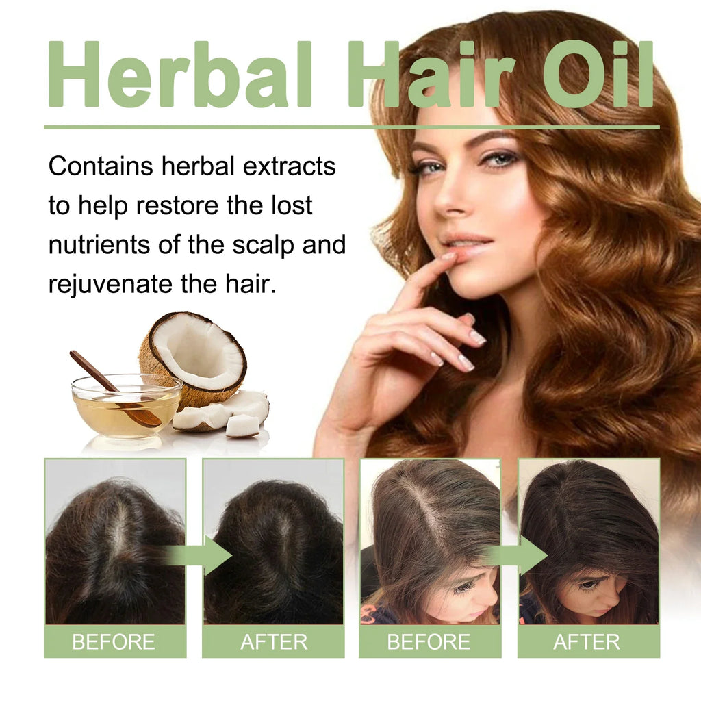 Adivasi Herbal Rosemary Hair Growth Oil – Hydrate & Restore Herbal Hair Growth Oil Qme