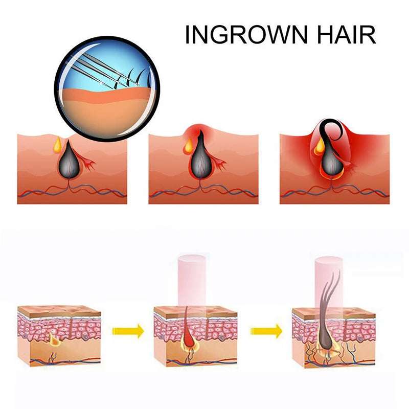 70-LED Red Light Therapy Hair Cap – 660nm & 850nm Growth LED Hair Growth Cap Qst