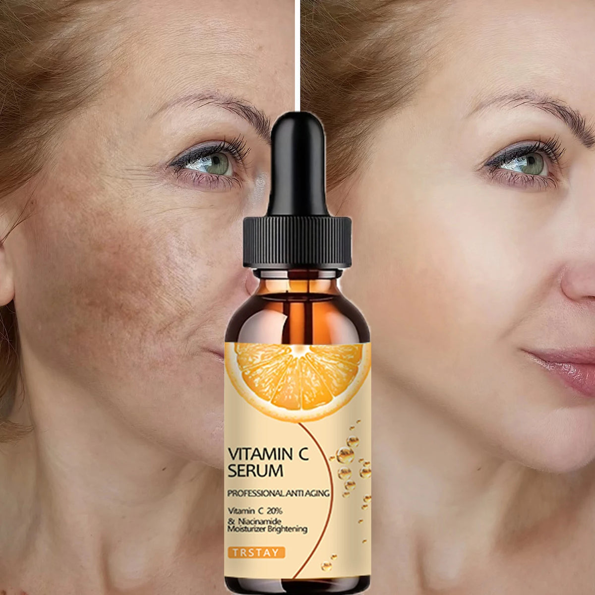 YRFKT Vitamin C Face Serum – Hydrating Nourishing Essence Vitamin C Face Serum Qst 15ml
