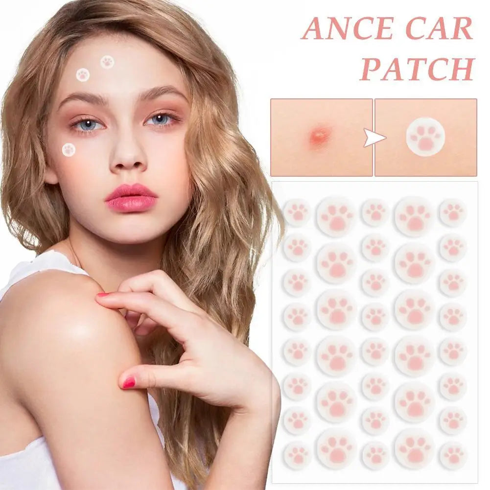 Hydrocolloid Pimple Patches 36ct | Cute Cat Paw Shape | Qme Pimple Patch Qme