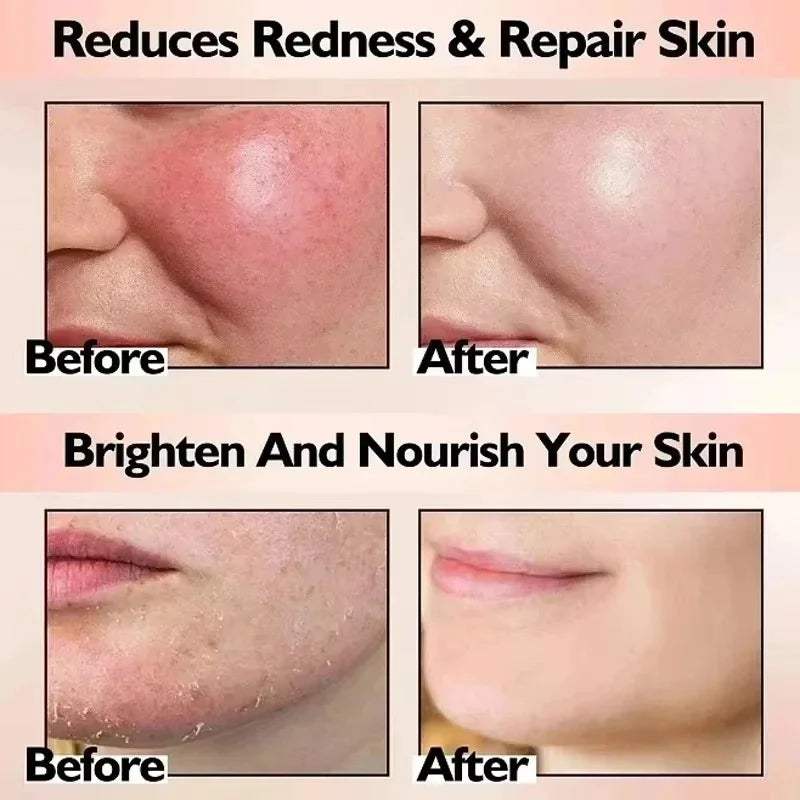 Sensitive Skin Facial Cream – Calming Moisture & Hydration Face Moisturizer Cream Qme