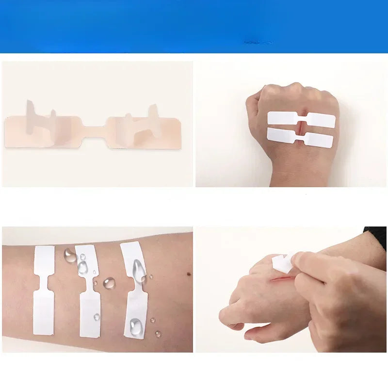 Waterproof Butterfly Closure Adhesive Bandages 10 Pack First Aid Bandages Qme