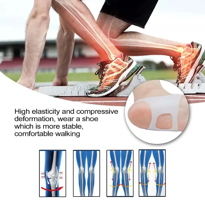 Silicone O-Type Arch Support Insoles – Non-Slip Foot Pads Arch Support Insoles Qme