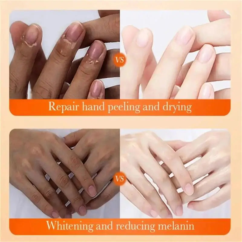 Brightening Hand Cream – Dark Knuckle & Melanin Corrector Brightening Hand Cream Qme