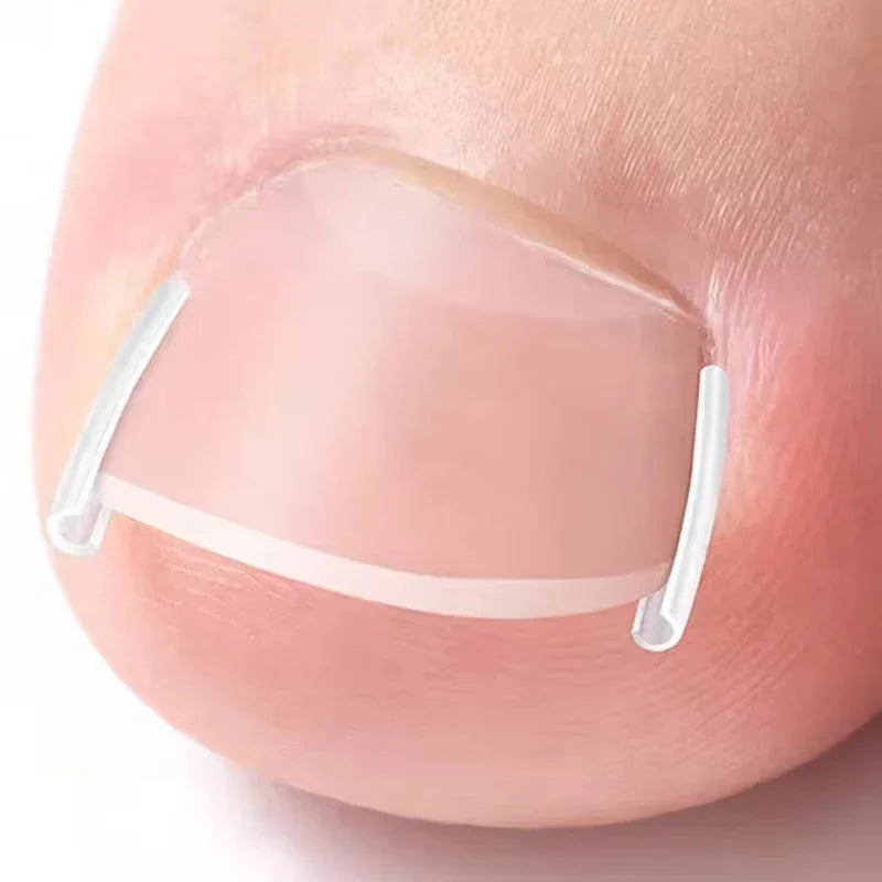 Invisible Toenail Shaping Support Stickers – 50pc Nail Care Nail Care Stickers Qme