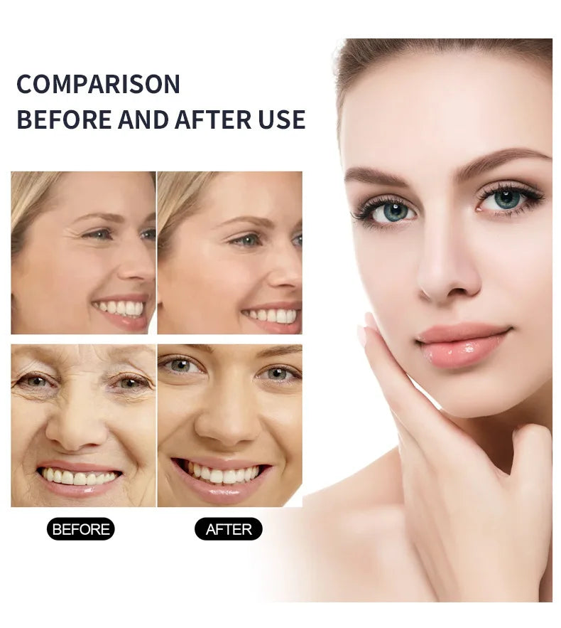 Retinol Firming Face Serum – Anti-Aging, Pore & Dark Spot Serum Face Serum Qst