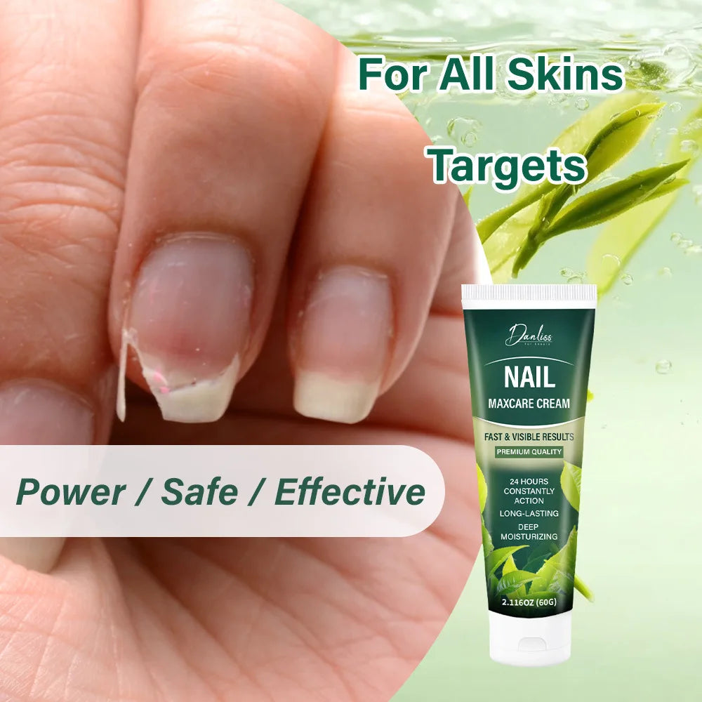 Lanemay Nail Maxcare Cream – 24H Deep Moisturizing Cuticles Nail Cuticle Cream Qst