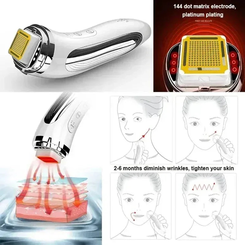Vilnason Dot Matrix RF Facial Lifting & Skin Tightening Device Facial Lifting Device Qst