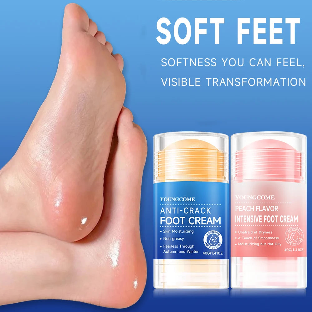 YOUNGCOME Cracked Heel Cream 2-Pack – Moisturizing Foot Ointment Foot Heel Cream Qst