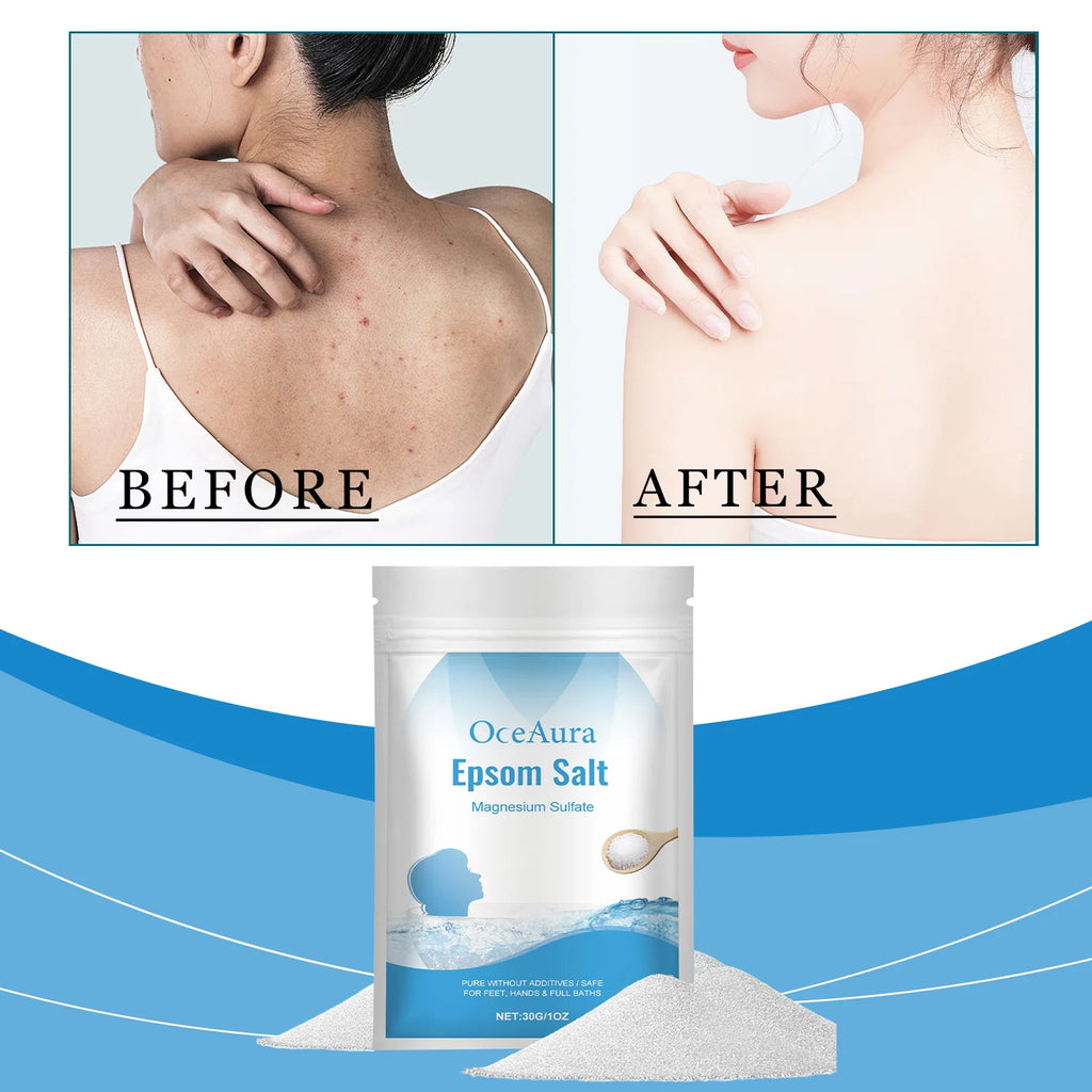 OceAura Epsom Salt Bath Soak – Mineral Exfoliating Bath Salts Mineral Bath Soak Qst