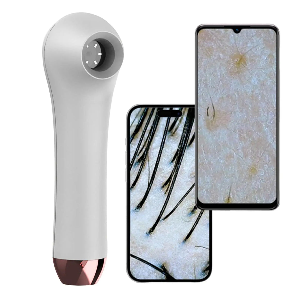 HD Scalp & Hair Follicle Analyzer – Skin & Pore Detector Scalp Skin Analyzer Qst