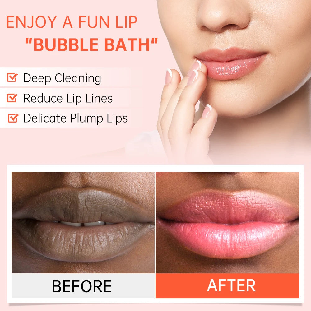 JoyPretty Bubble Lip Mask – Exfoliating & Moisturizing Lip Balm Lip Mask Treatment Qst