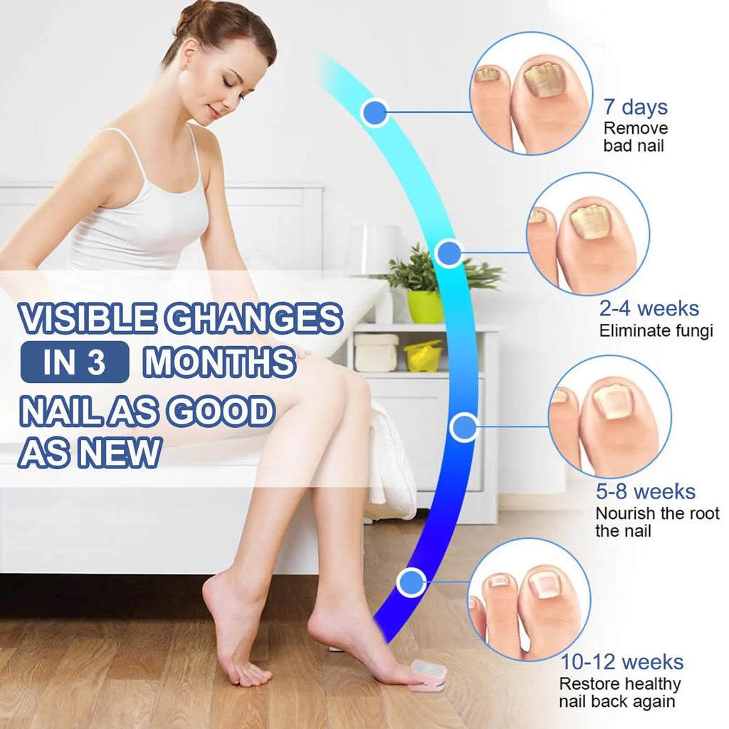 Jitesy Nail Light Therapy Device – Blue LED & Laser Foot Care Nail Light Therapy Device Qst
