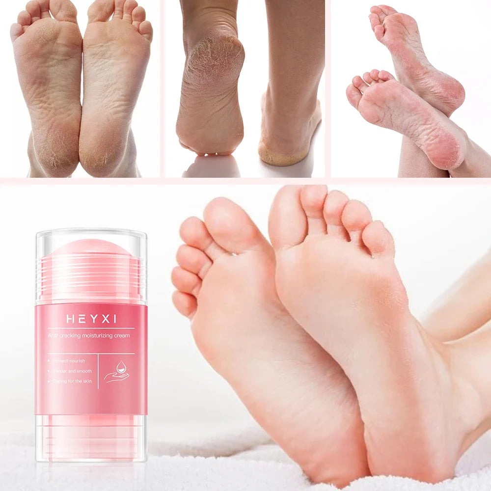 Crack-Resistant Foot Cream for Dry Skin – Deep Moisture Foot & Hand Cream Qme