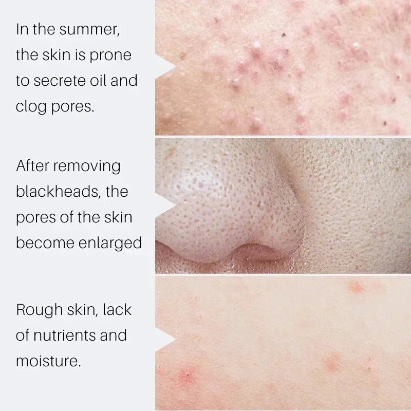 Salicylic Acid Pore Minimizing Serum | Smooth & Refined Skin Pore Minimizing Serum Qme
