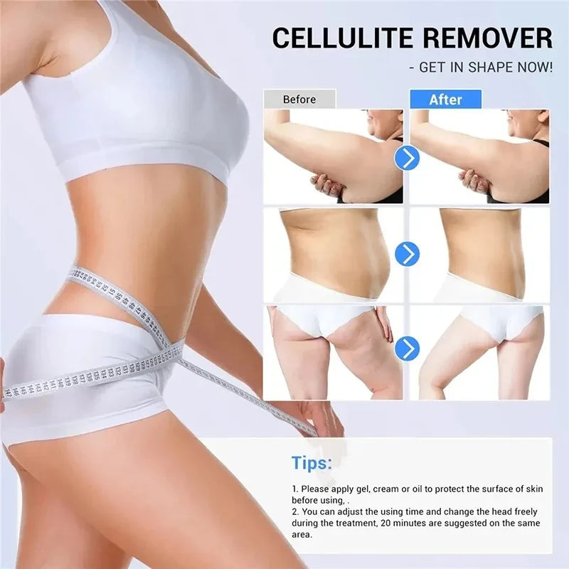80K Cavitation RF Ultrasonic Body Slimming Machine – 3-in-1 Body Slimming Machine Qst