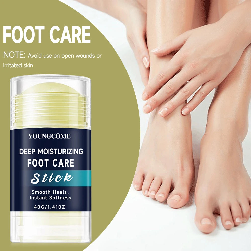 YOUNGCOME Deep Moisturizing Foot Cream – Nourishing & Smoothing Foot Care Cream Qst