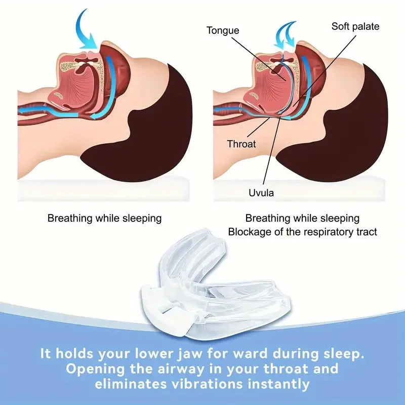 Adjustable Silicone Night Mouth Guard – Teeth Grinding & Snoring Night Mouth Guard Qst