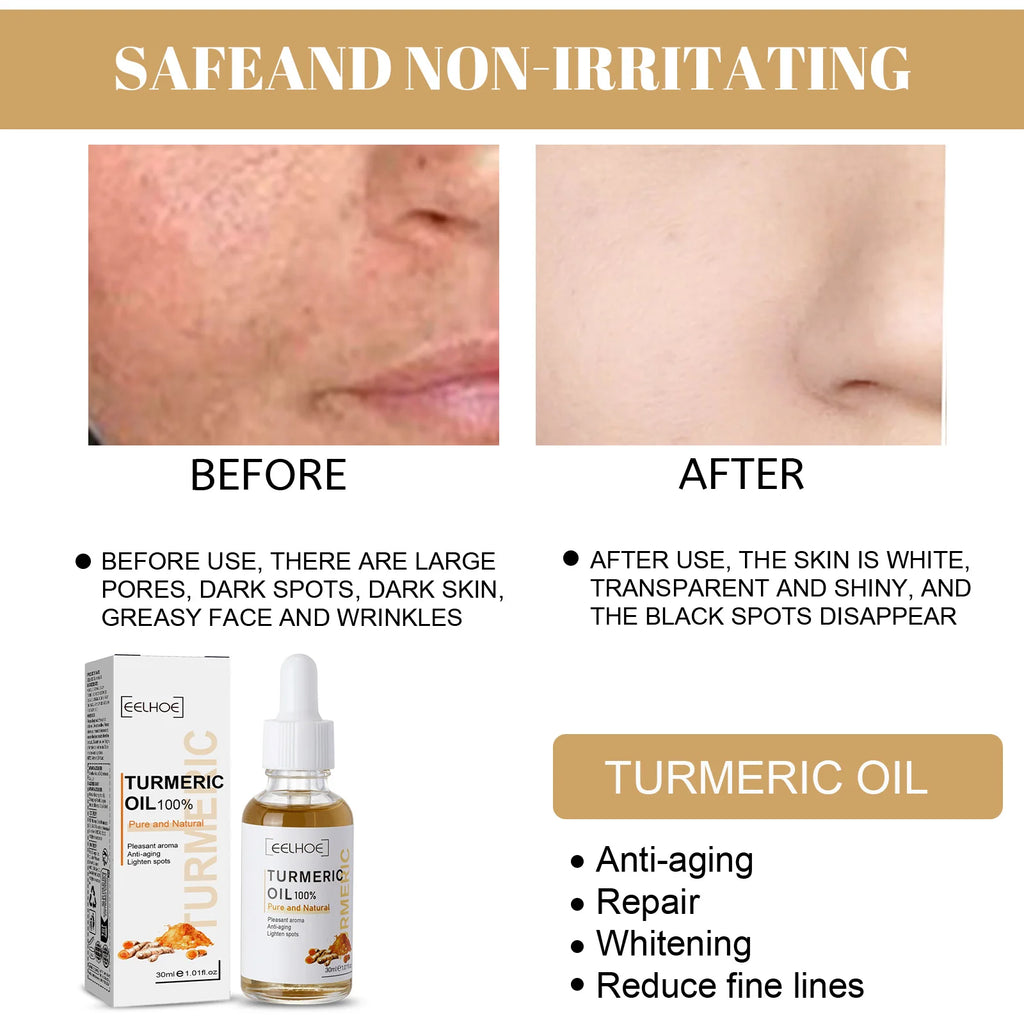 Eelhoe Turmeric Brightening Face Serum – Dark Spot & Tone Brightening Face Serum Qst