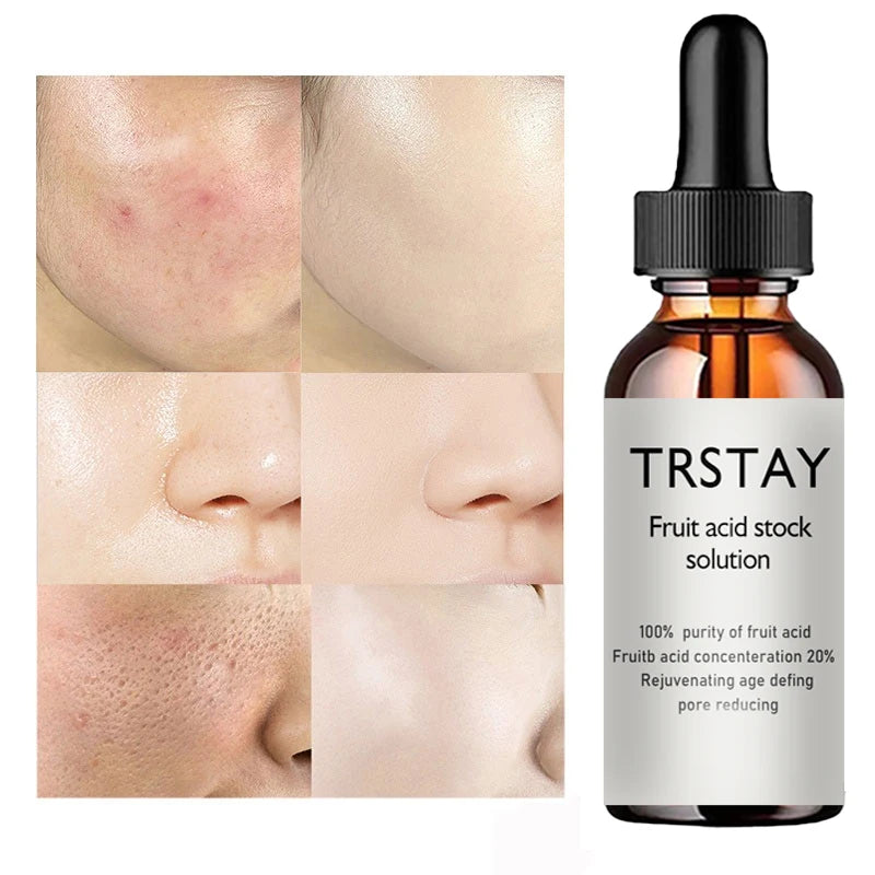 YRFKT Glycolic Acid Facial Oil Essence – Anti-Aging Serum Facial Serum Qst