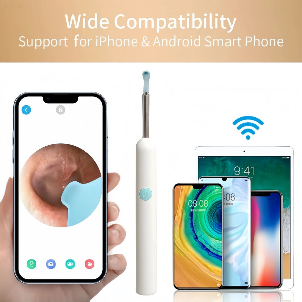 Visual Ear Wax Cleaner with HD Camera & LED – iOS & Android Ear Cleaning Camera Qst