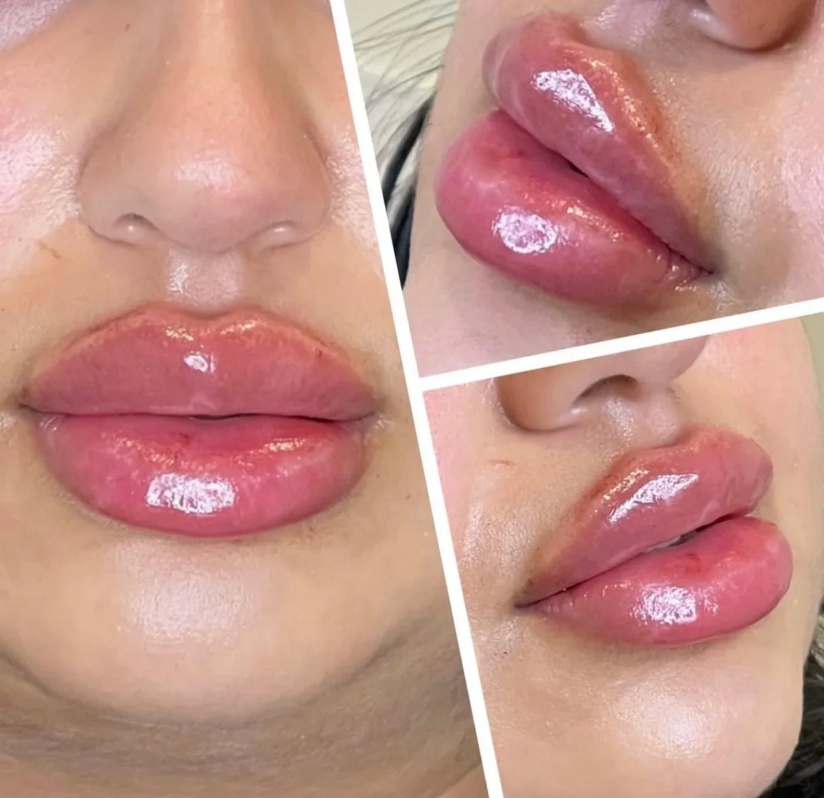 Spicule Plump Lip Shot – Volumizing Lip Gloss | Qme Lip Plumping Gloss Qme
