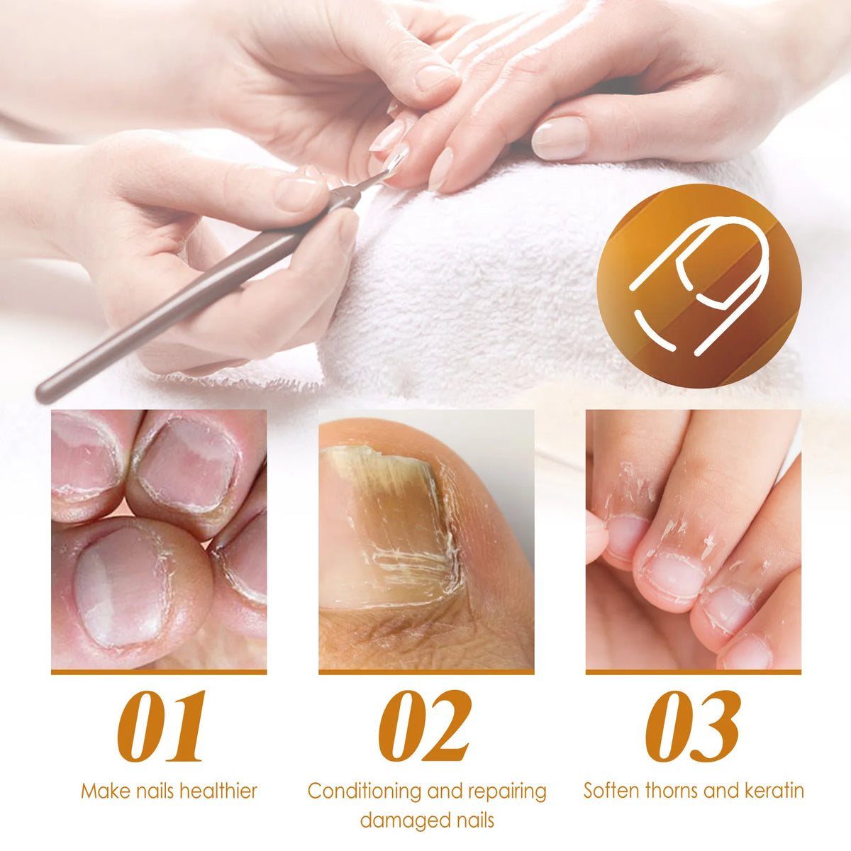 EELHOE Cuticle Remover Gel – Nail Repair & Dead Skin Gel 30ml Cuticle Remover Gel Qst