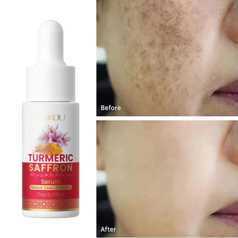 Turmeric Brightening Essence – Dark Spot & Pigmentation Serum Brightening Face Serum Qme