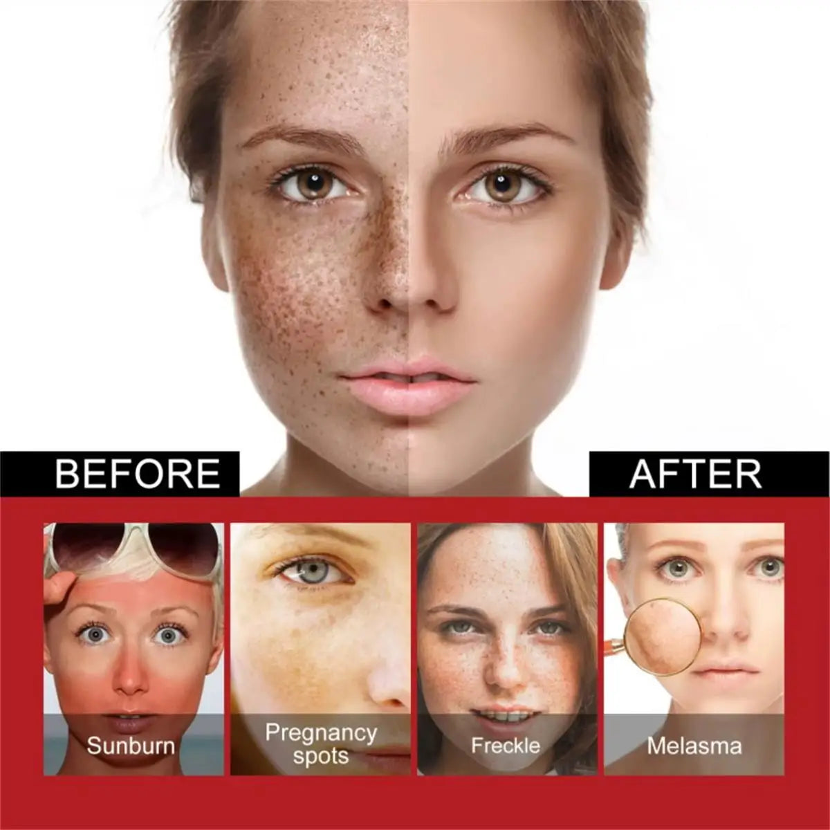 Brightening Dark Spot & Freckle Face Cream – Niacinamide Brightening Face Cream Qme