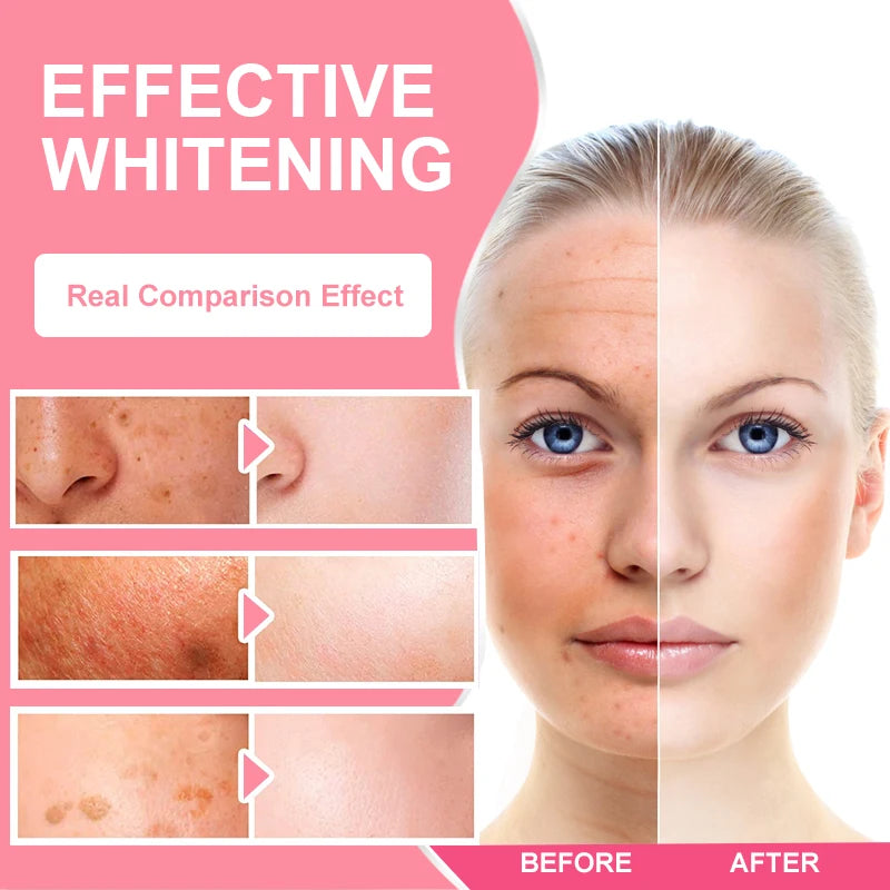 Yimiduk Brightening Capsules – Vitamin C, Grape Seed & Collagen Skin Brightening Supplement Qst