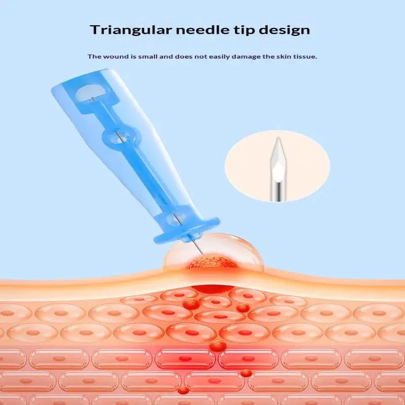 Disposable Blackhead Remover Needles – 50 Pcs Stainless Steel Facial Cleansing Tool Qme