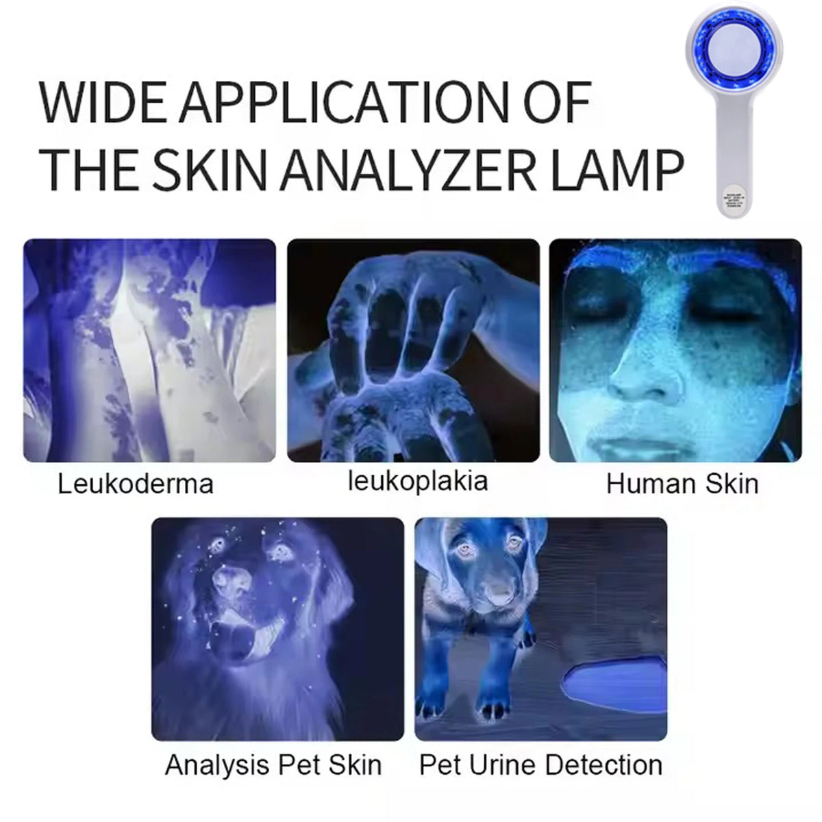 Wood's Lamp UV Skin Analyzer – Portable USB Rechargeable Tool UV Skin Analyzer Qst