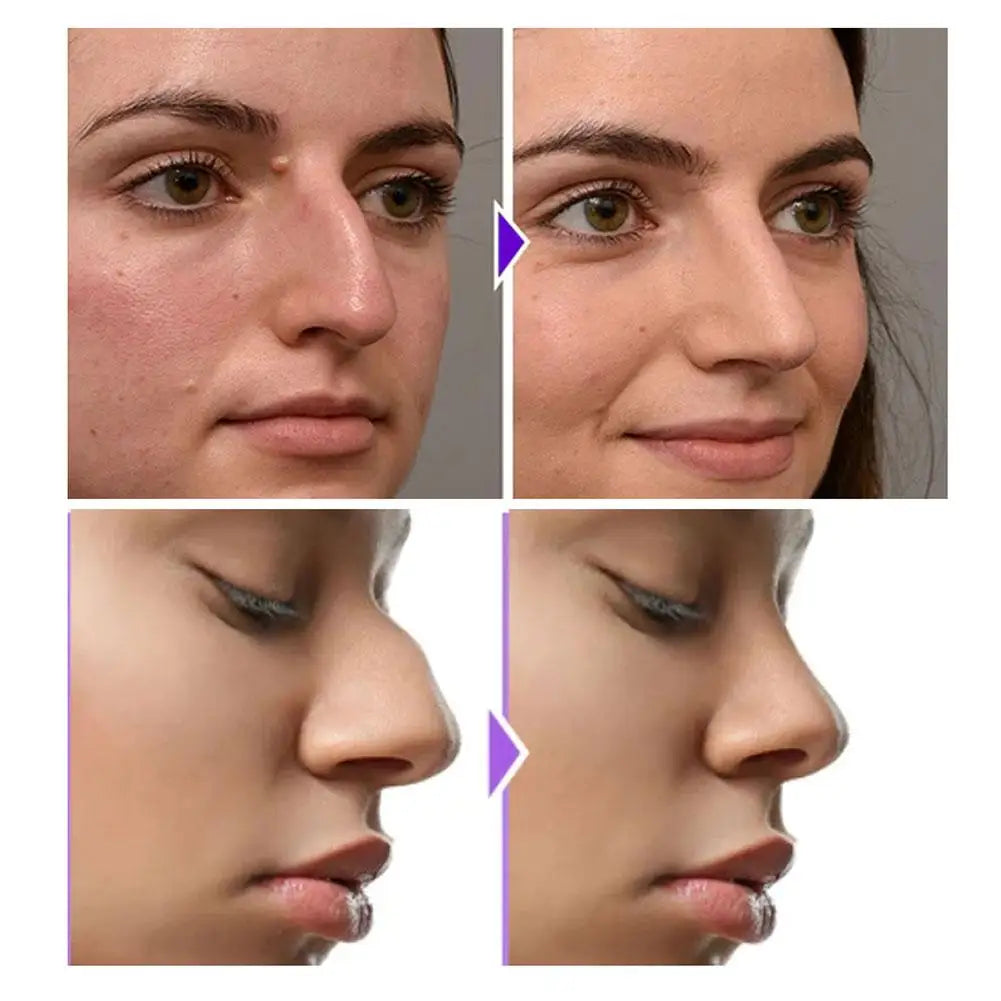 Soft Silicone Nose Shaper Clip – Lifting & Sculpting Tool Nose Shaping Clip Qme
