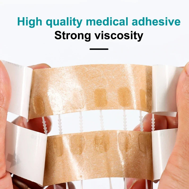 Zipper Wound Closure Strips – Sutureless Adhesive Skin Patches Wound Closure Strips Qme