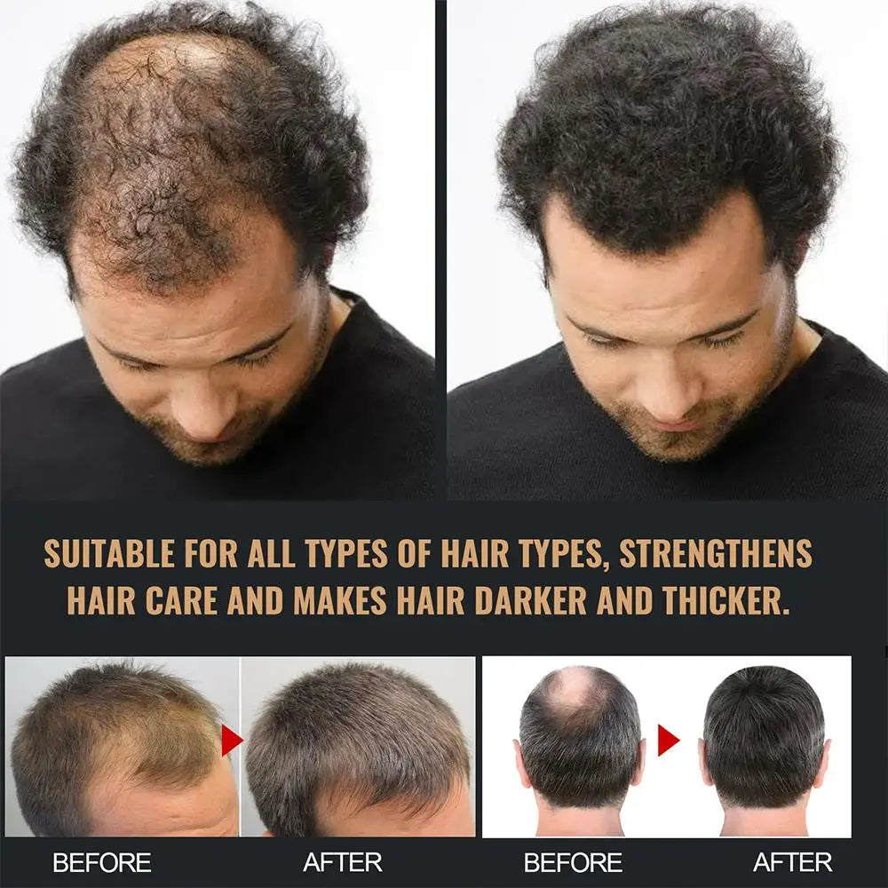 Hair Thickening Root Activator Nourishing Shampoo | Qme Hair Thickening Shampoo Qme