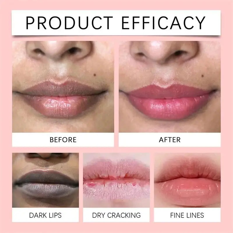 Brightening Lip Mask Balm Serum – Exfoliating Lip Care | Qme Lip Mask Serum Qme