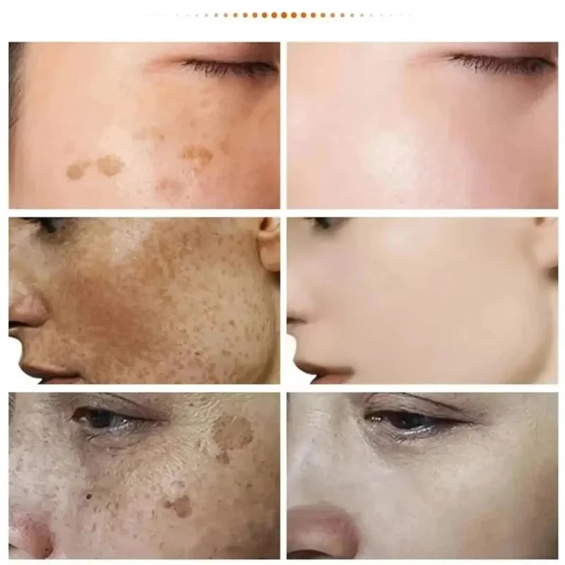 Brightening Face Cream – Firming, Moisturizing & Anti-Wrinkle Brightening Face Cream Qme