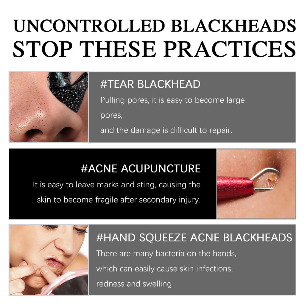 EELHOE Magnetic Blackhead Cleansing Mask – Pore Tightening 50g Blackhead Cleansing Mask Qst