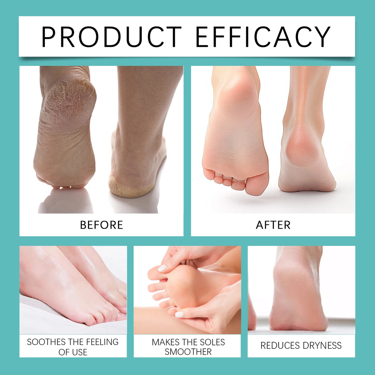 Foot Peeling Spray – Exfoliating Callus & Dead Skin Remover Foot Exfoliating Spray Qst