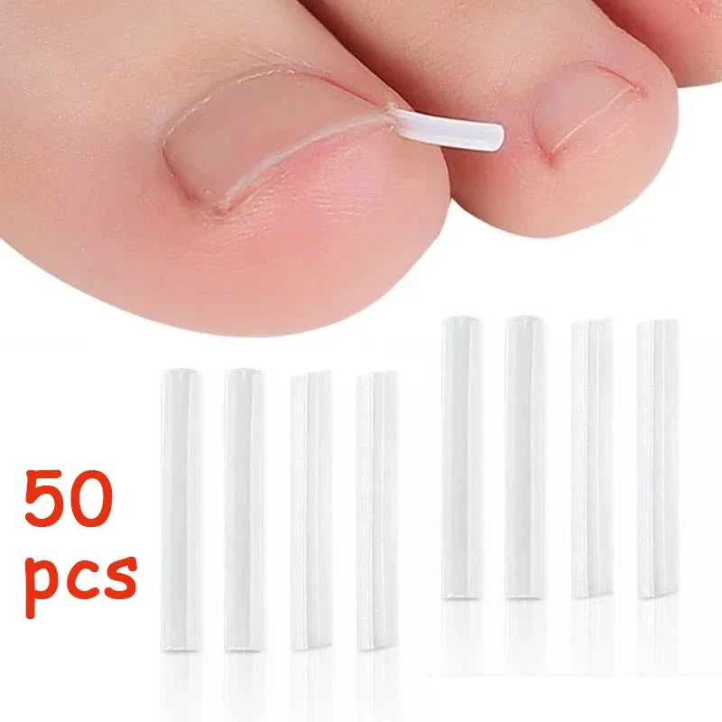Invisible Toenail Shaping Support Stickers – 50pc Nail Care Nail Care Stickers Qme Default Title