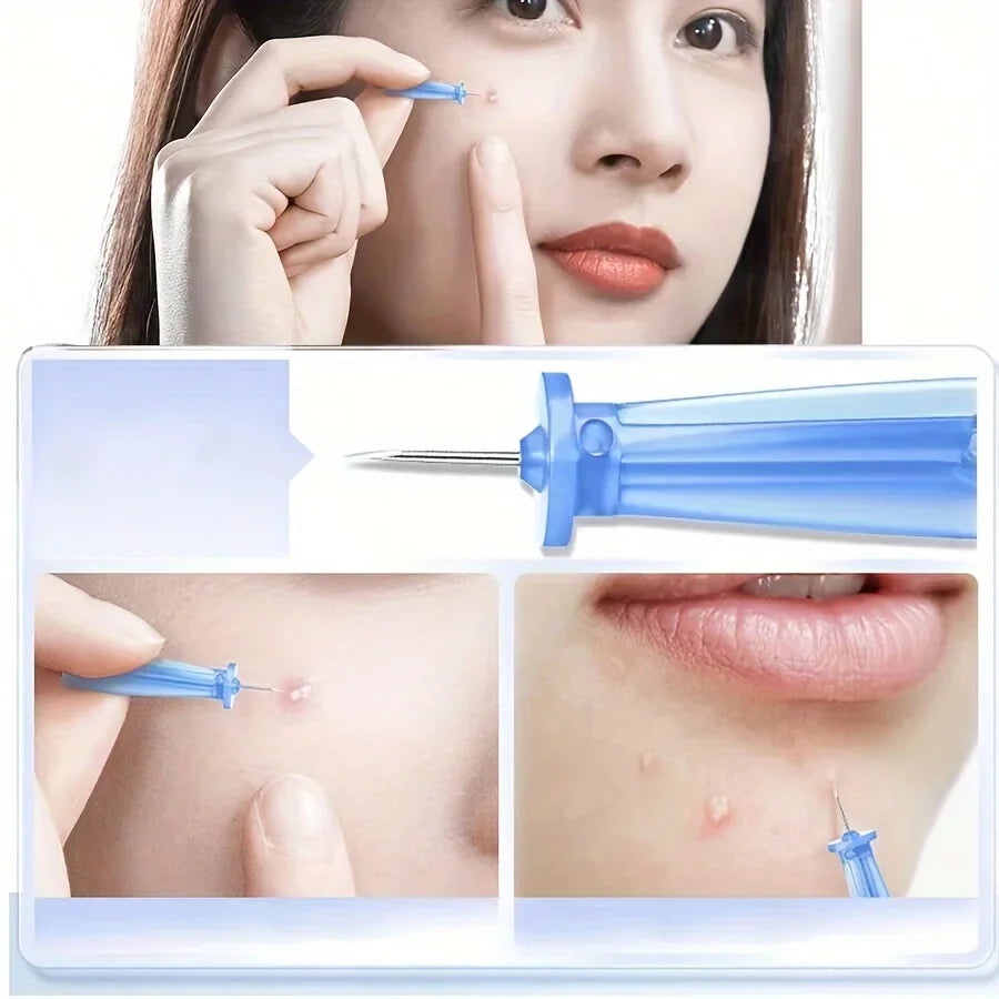 Blackhead & Pore Clearing Kit with Fine Needles | Qme Pore Clearing Tool Kit Qme