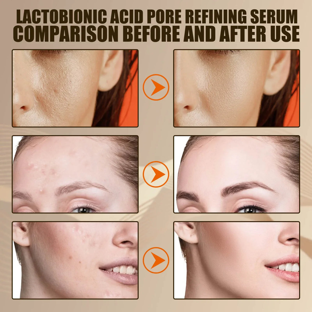 Lactic Acid Pore-Minimizing Serum | Blackhead & Moisture Boost Facial Serum Qme