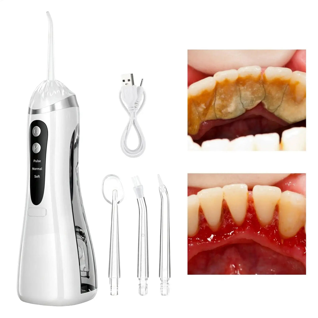 Rechargeable Electric Water Flosser & Brace Irrigator Electric Water Flosser Qme
