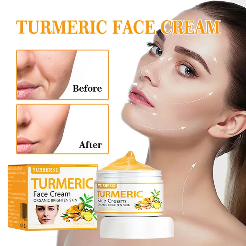 YURHERSU Turmeric Brightening Face Cream 50ml – Dark Spot Cream Brightening Face Cream Qst