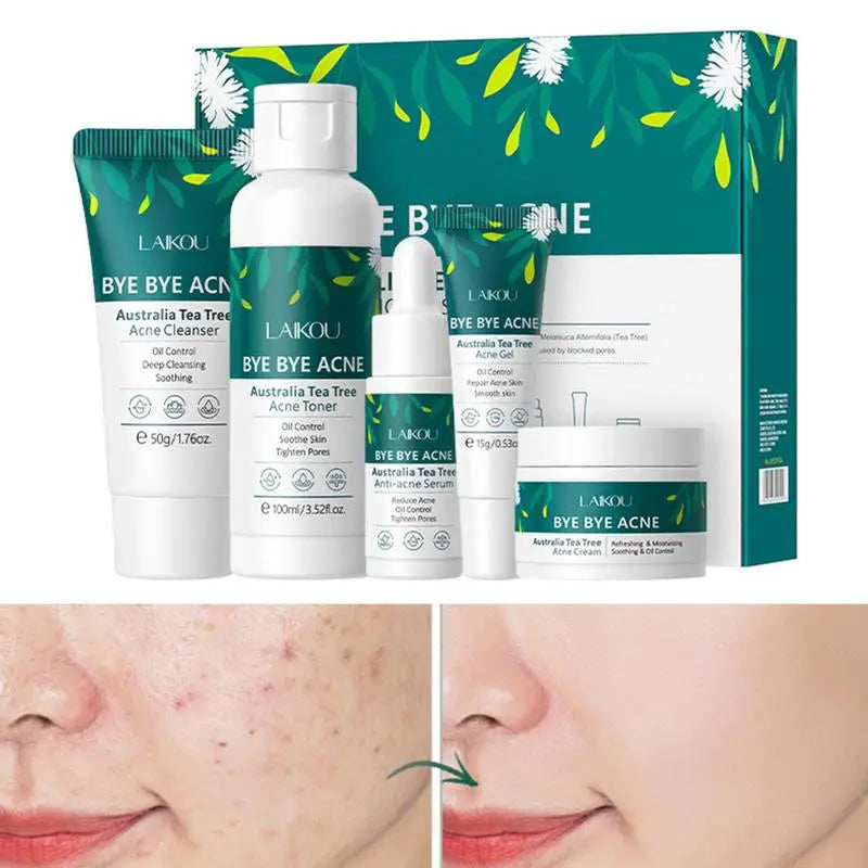 Tea Tree Skin Care Set – 5-Piece Cleanser, Toner & Moisturizer Skin Care Set Qst