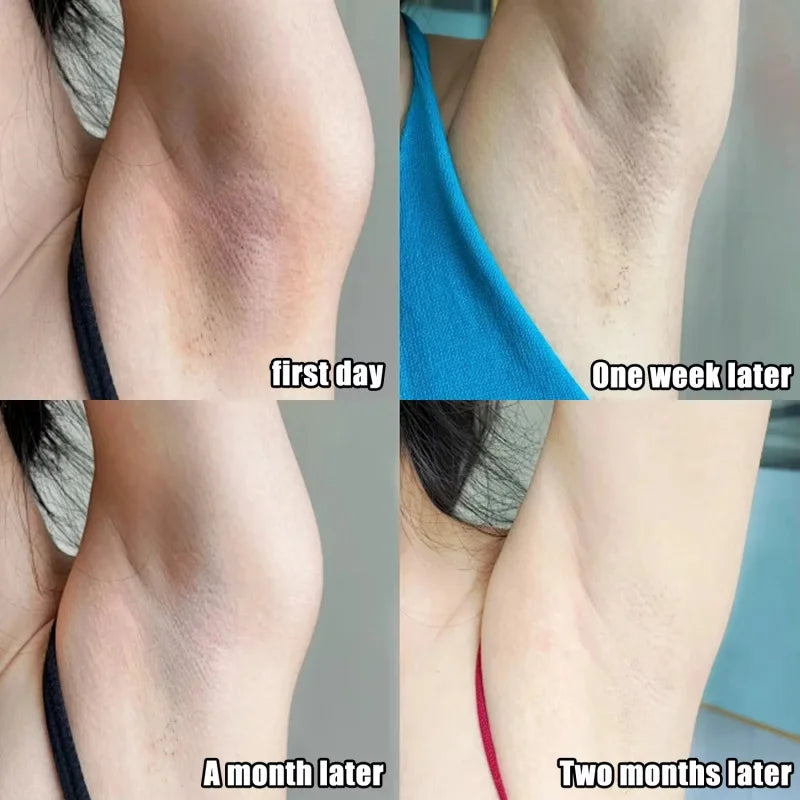 Brightening Serum Cream – Underarm, Knee & Intimate Areas Brightening Body Serum Qme