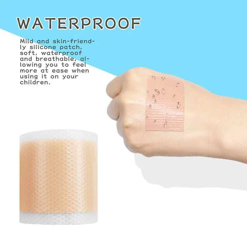 Silicone Scar Sheets Roll 4cm×150cm – Reusable Self-Adhesive Silicone Scar Sheet Qme