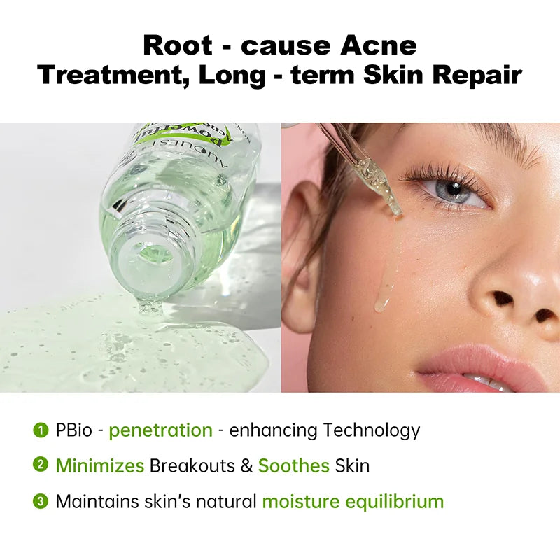 AUQUEST Acne Serum – Salicylic Acid Oil Control Face Serum Acne Face Serum Qst